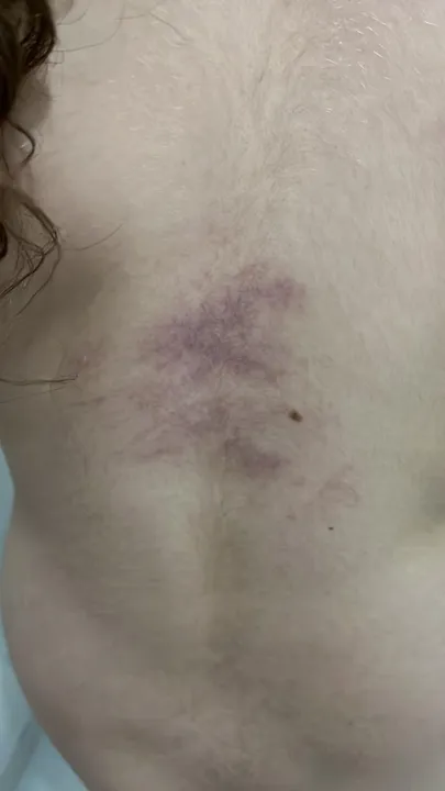 Mãe denuncia clínica em São Gonçalo por agressão a filha autista durante sessão de fonoaudiologia