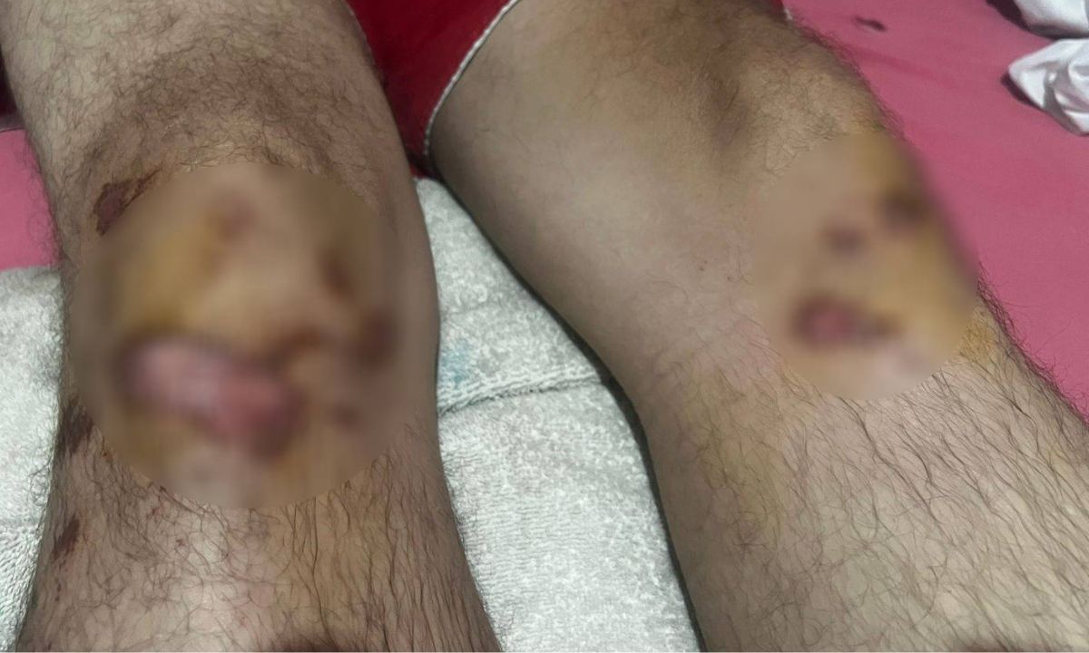 Motorista de app é brutalmente espancado após corrida de R$ 20 em São Gonçalo