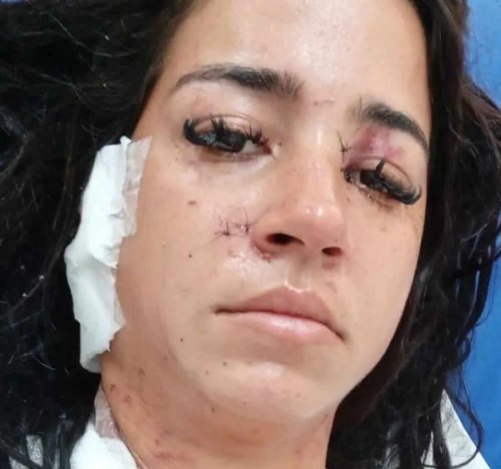Viúva é esfaqueada 34 vezes em ataque na Zona Oeste do Rio; sogra e suposta amante do marido são apontadas como suspeitas