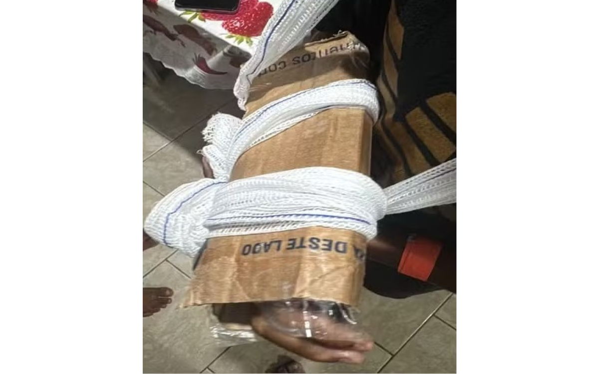 Criança quebra braço e recebe tala de papelão em UPA de São Pedro da Aldeia