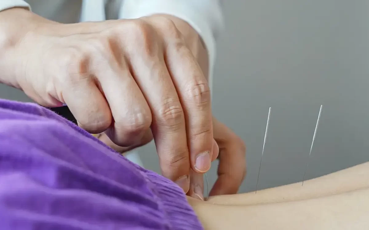 Brasil regulamenta exercício profissional da acupuntura