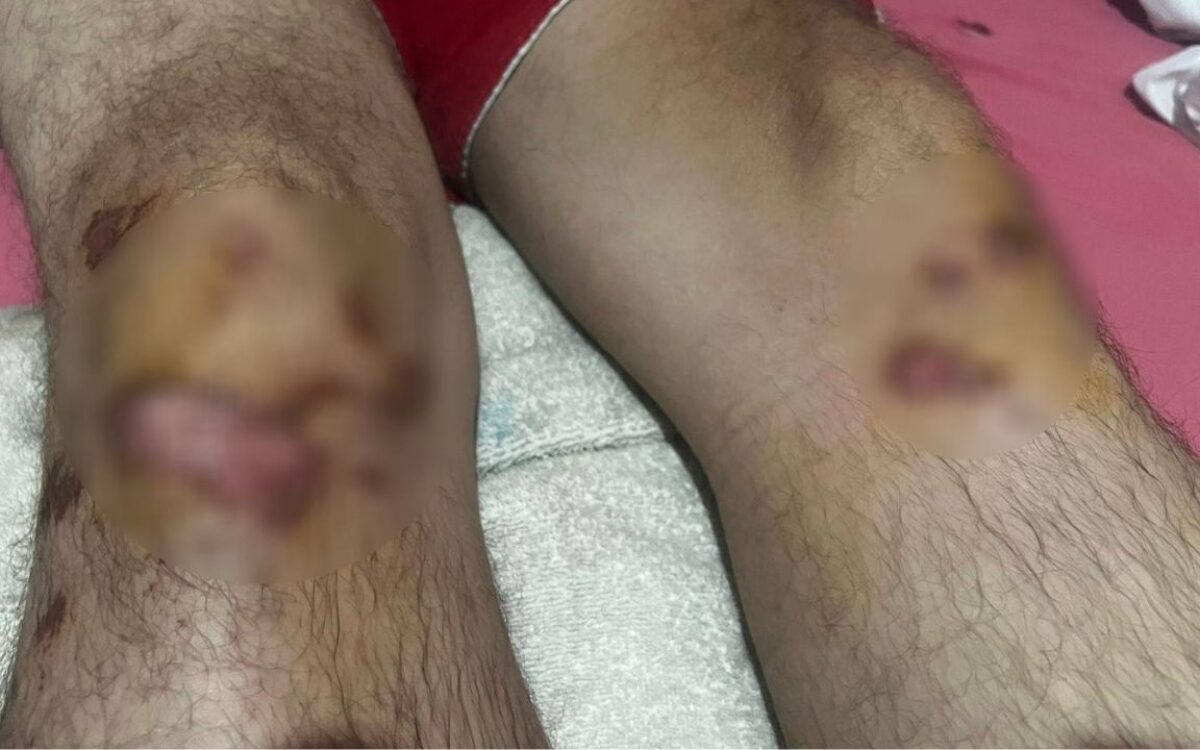 Motorista de app é brutalmente espancado após corrida de R$ 20 em São Gonçalo